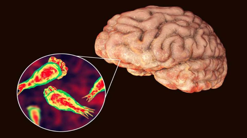 La atención oportuna es vital para salvar la vida de una persona cuando se sospecha de la infección; entérate de dónde puede ser encontrada y los síntomas