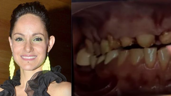 Desfiguran dientes a Lolita Cortés; esto fue lo que le pasó VIDEO