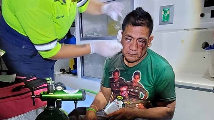 Se le mete el espíritu de 'Mike Tyson' y le arranca la oreja a su mejor amigo