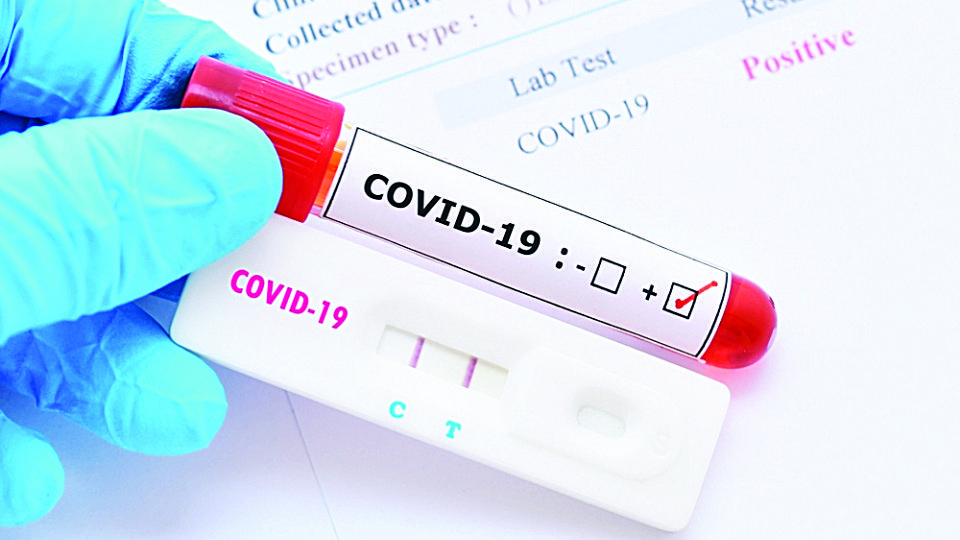 Se incrementaron las pruebas de Covid-19 en la comunidad.