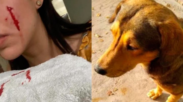 'Rodolfo Corazón' me atacó: novia de hombre que mató a hachazos a perro