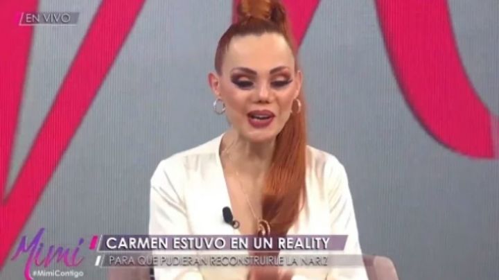 ¿Nueva cirugía? Así luce ahora la nariz de Carmen Campuzano
