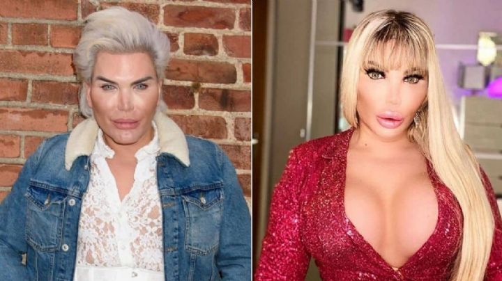 FOTOS: ¡Quería ser KEN, pero acabó como BARBIE! Requirió más de 60 cirugías estéticas