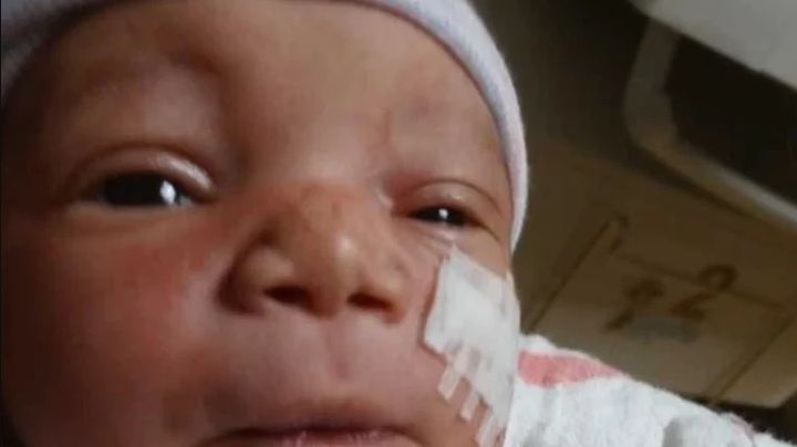 ¡NEGLIGENCIA IMPERDONABLE! Cortan mejilla a recién nacido en cesárea de emergencia