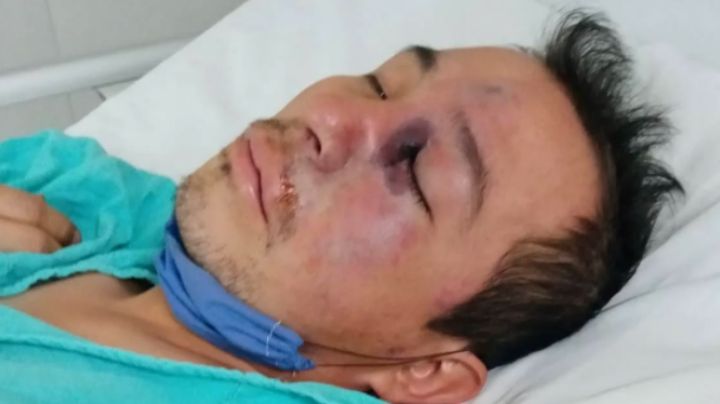 ÚLTIMA HORA: Detectan primer caso de HONGO NEGRO post COVID-19 en México