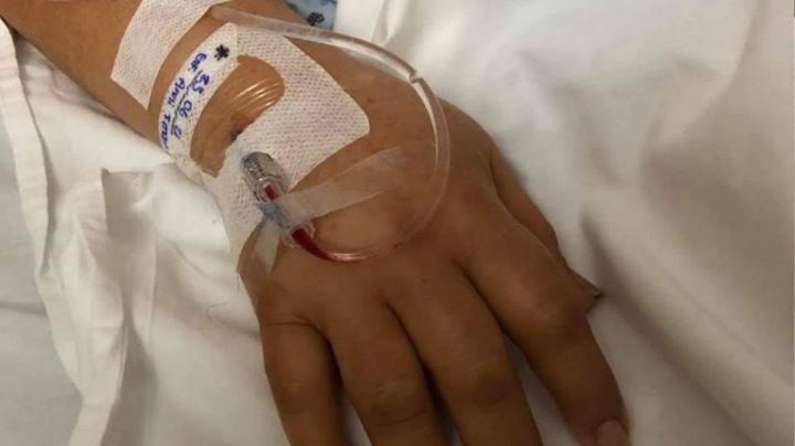 Primer caso de hongo negro en Tamaulipas, mujer perderá su ojo