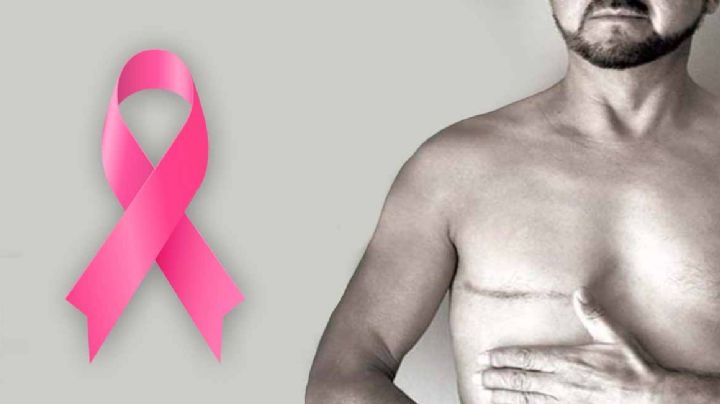 Cancer de mama en hombres: fallecen dos en Tamaulipas