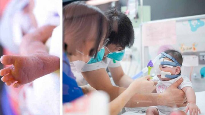 Bebé prematura pesó 200 gramos al nacer, se aferra a la vida y ya está en casa 13 meses después