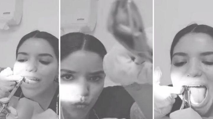 VIDEO: Dentista se quita sola las muelas del juicio y sorprende en redes sociales