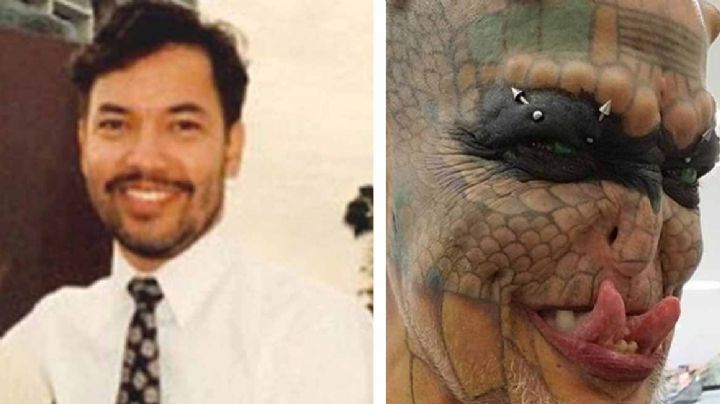 Para ser hombre dragón gasta un millón de pesos en cirugías; va por castración total