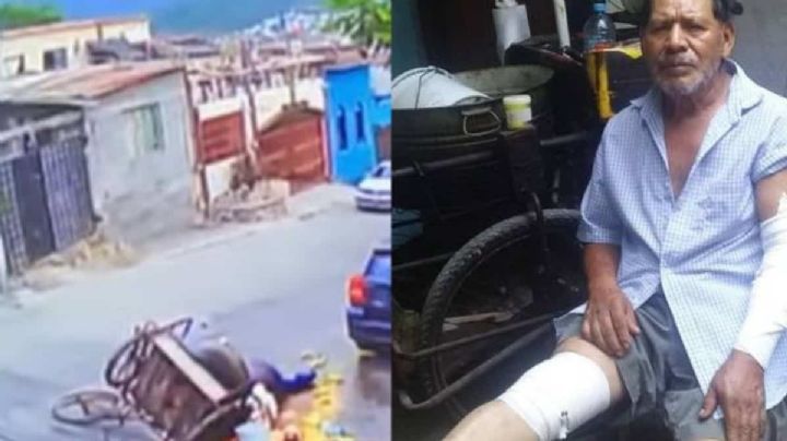 VIRAL: Elotero se cae con carrito y sufre quemaduras; usuarios buscan apoyarlo