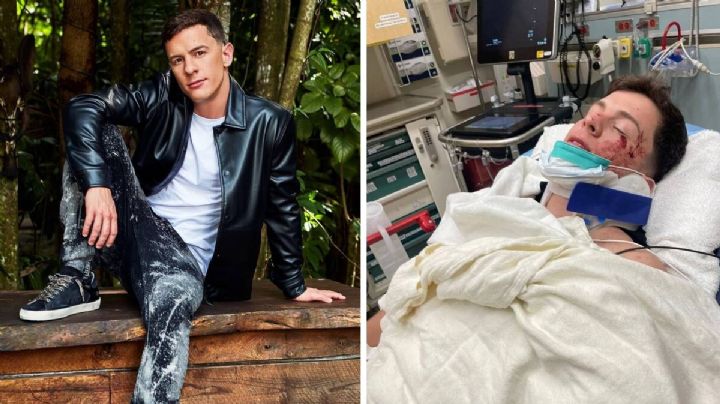 Guaynaa sufre fuerte accidente automovilístico en Los Ángeles