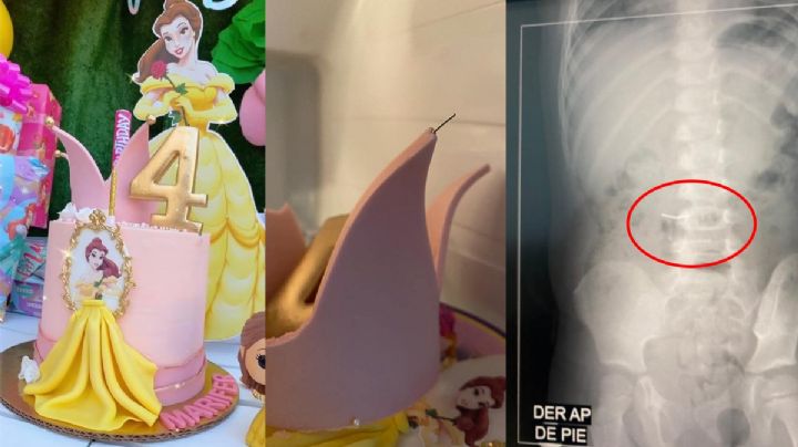 Colocan alfiler en la decoración de pastel; la vida de 2 niñas peligra. FOTOS