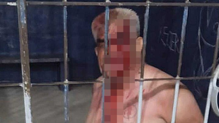 Autoridades: "Shocker intentó suicidarse con su calzón", pero redes denuncian abuso de policías