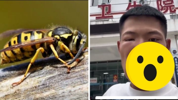 Influencer termina desfigurado del rostro por comer una avispa | VIDEO