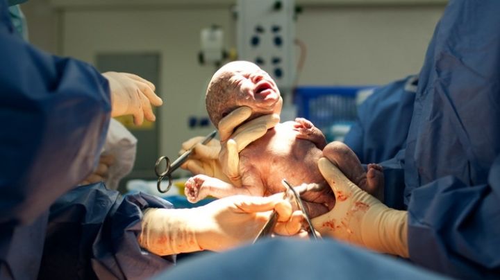 Nace bebé con una cola en Nuevo León; médicos se la extirpan