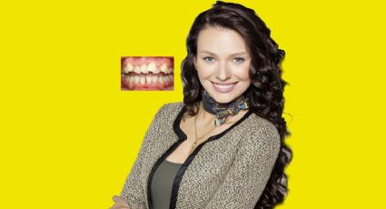 Irina Baeva con dientes chuecos: así era antes de la fama | FOTOS