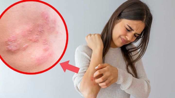 ¿Será Covid-19? Conoce sus síntomas inusuales y que no te agarre desprevenido