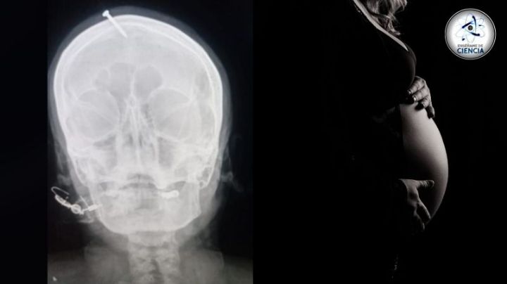 Curandero "martilla" un clavo en la cabeza de una mujer embarazada para darle un varón