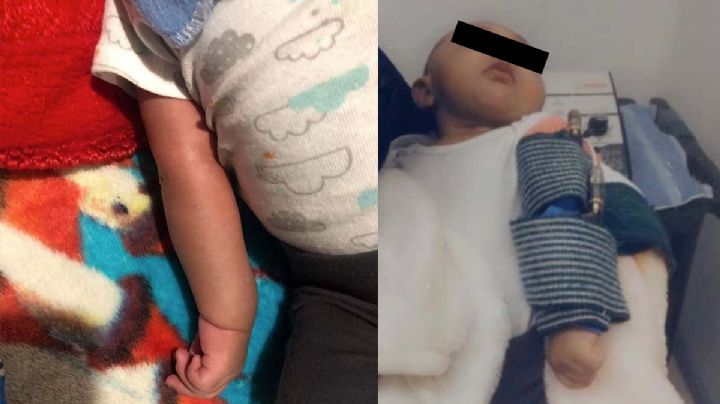 Demandan a hospital de Nuevo Laredo por lesión a recién nacido FOTOS