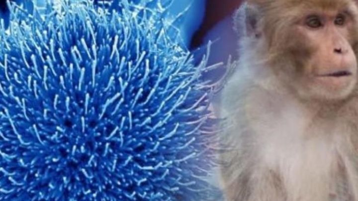 ¿Nueva epidemia? Portugal reporta 5 pacientes con viruela del mono; España tiene 8 posibles casos