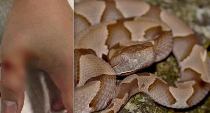 Serpiente ‘copperhead’ muerde niño de cinco años en Texas