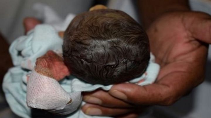 Por apagón alumbran cesárea con celulares y cortan oreja a bebé