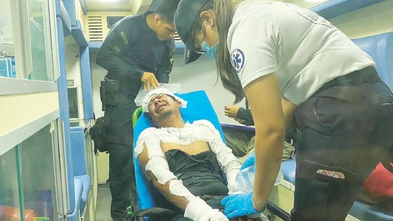 El hombre resultó con quemaduras en cabeza, pecho y ambas manos.
