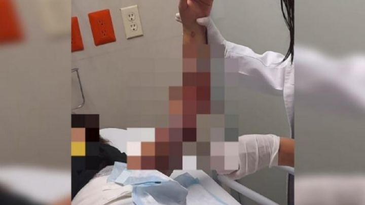 Envía a su hija a "centro de rehabilitación"; es quemada y torturada por el persona a su cargo