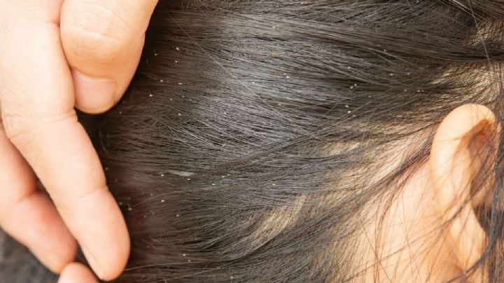 Instalan filtros en escuelas para detectar Covid-19... ¡y encuentran piojos!