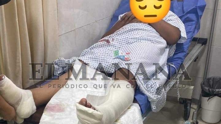 Una niña de 11 años también fue atropellada por conductor en pulga de Villas