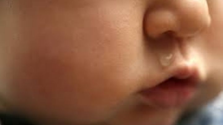 Por meterse un frijol a la nariz, bebé muere tras seis días hospitalizado