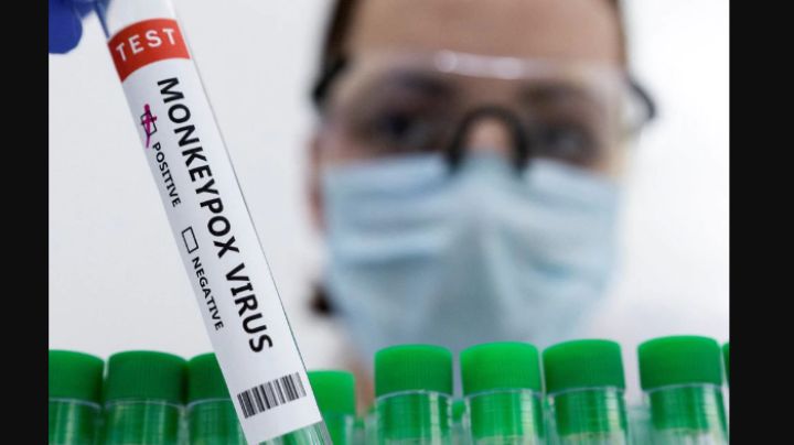 Viruela del mono supera los 50 mil casos a nivel mundial