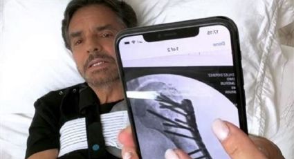 Eugenio Derbez rompe el silencio sobre accidente que sufrió | VIDEO