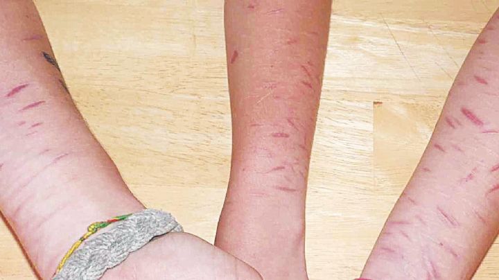 ¿Por qué se cortan los brazos los estudiantes en escuelas de Nuevo Laredo?