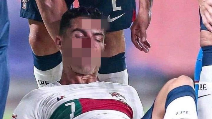 Portero le destroza la cara a Cristiano Ronaldo al chocar de frente | VIDEO