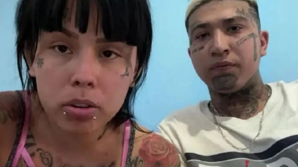 La influencer se sometió a cirugía en Colombia