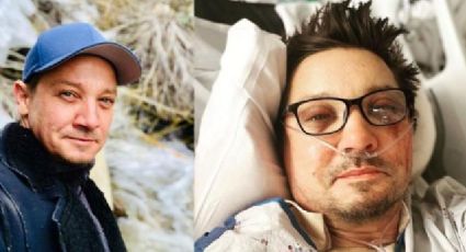 Actor de Hawkeye revela que se rompió más de 30 huesos en su accidente