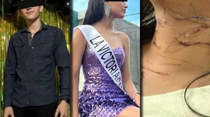 Mya Naomy Villalobos sobrevivió a 47 navajazos; el culpable, su ex novio, está libre | FOTOS