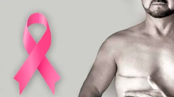 Cáncer de mama en hombres; estos son los síntomas y tratamiento
