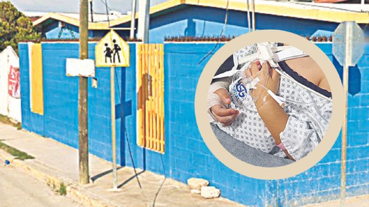 Horrible accidente: perros atacan a niña de 5 años dentro de kínder en la colonia Voluntad 4