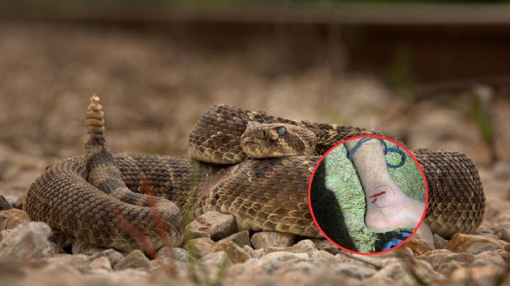 Víbora Cascabel: Este es el lapso de tiempo que tienes para ir a un hospital