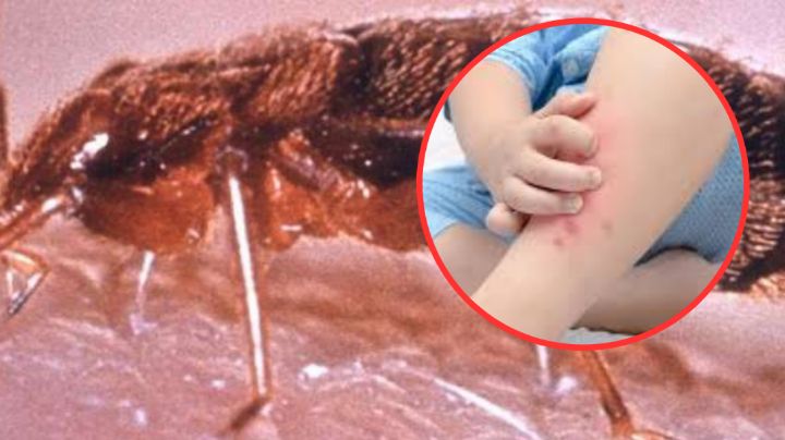 ¿Quieres eliminar chinches de tu hogar? Aquí te decimos como puedes hacerlo