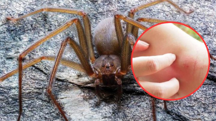 Araña violinista: ¿en qué estados del país suele vivir y cómo reconocer una picadura?