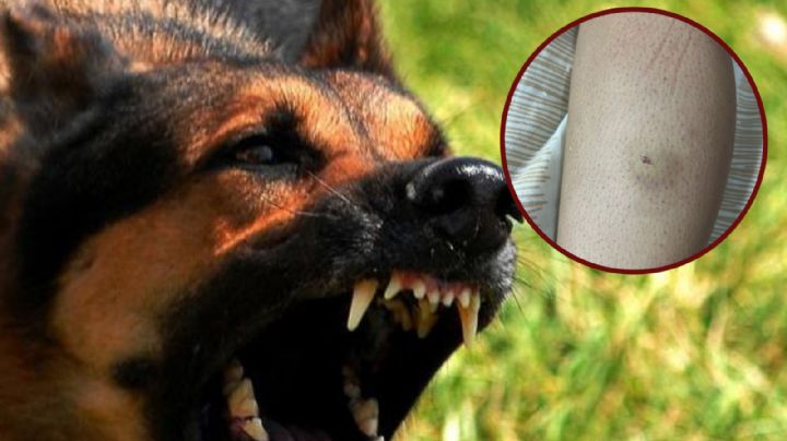 Investigan ataque de perro a estudiante de preparatoria LBJ en Laredo Texas