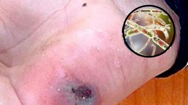 Advierte OMS sobre virus que pronto podría traspasar fronteras, te decimos de qué se trata