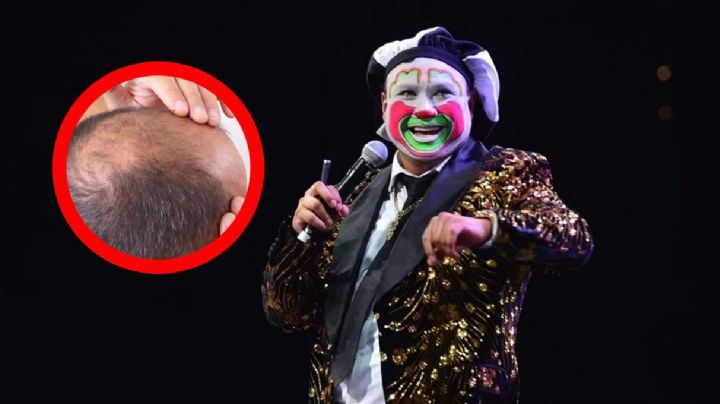 Brincos Dieras evita la calvicie con este milagroso remedio casero | VIDEO