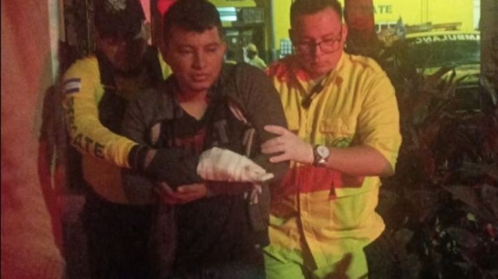 Amputan dedos de una mano a joven por jugar con pirotecnia en Navidad | VIDEO