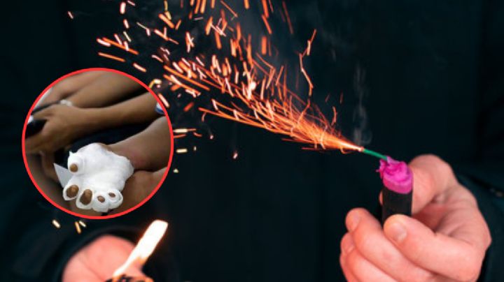 Sujeto por poco pierde los dedos al explotarle un 'cohete' en la mano en la colonia Matamoros