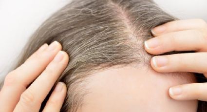 ¿Por qué salen las canas? Tratamientos para mantenerlas